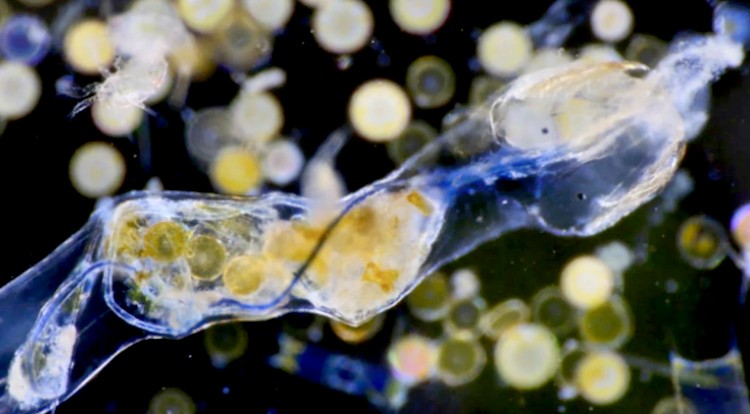 Plankton having ingested plastic microfibers